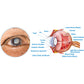 GFOUK™ OphthalTech Vision Vitality Electric Device