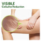 GFOUK™ MugwortsLegs Cellulite Reduction Patches