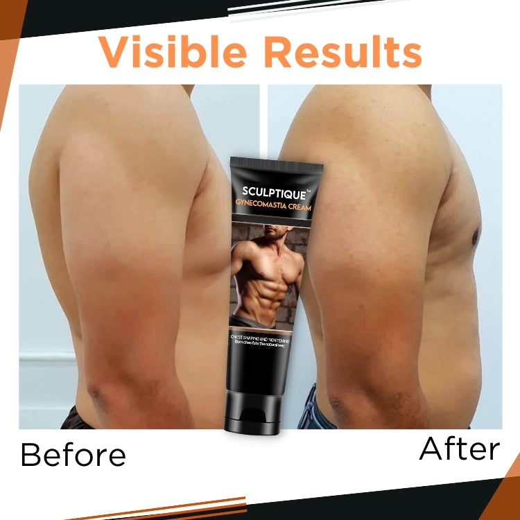 GFOUK™ Gynecomastia Cream