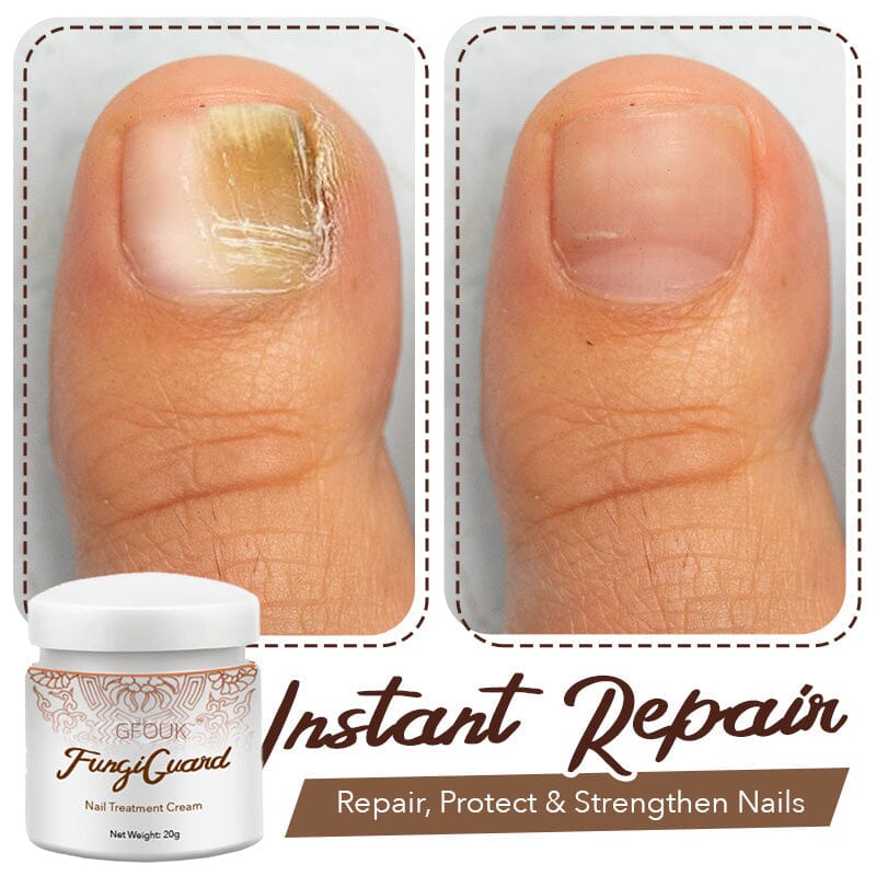 GFOUK™ FungiGuard Nail Treatment Cream