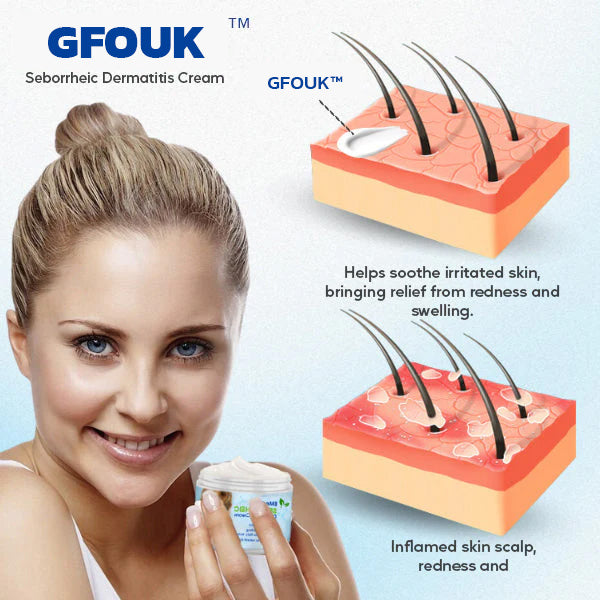 GFOUK™ Seborrheic Dermatitis Cream