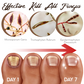 GFOUK™ FungiGuard Nail Treatment Cream