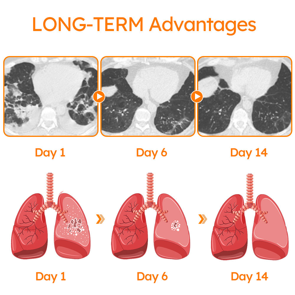 GFOUK™ PollenGuard Microcapsule Aspirator