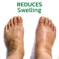 GFOUK™ GingerLegs Anti Swelling Detoxing Ointment