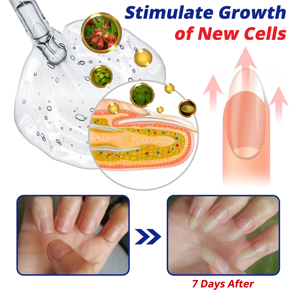 GFOUK™ NailFortify Rapid Growth Treatment Serum