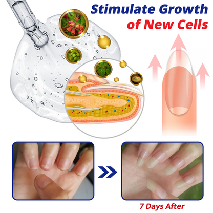 GFOUK™ NailFortify Rapid Growth Treatment Serum