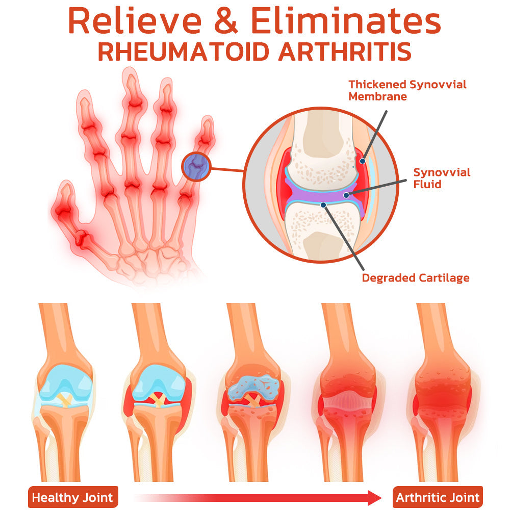 GFOUK™ DeerAntler Joint and Bone Therapy Balm