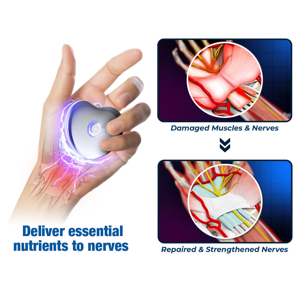 GFOUK™ NerveEase Carpal Tunnel Treatment Device