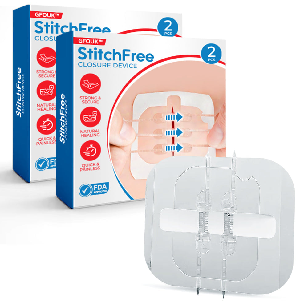 GFOUK™ StitchFree Closure Device