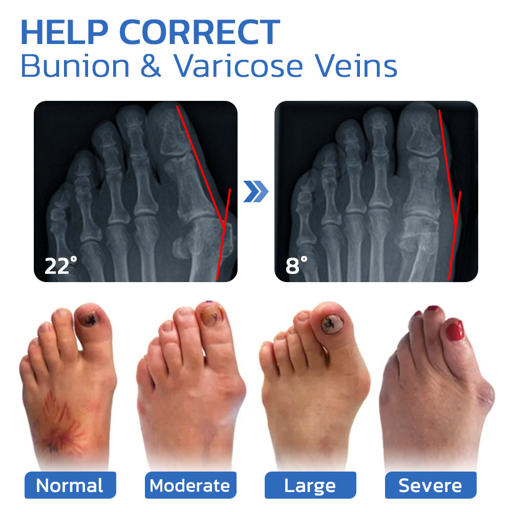 GFOUK™ AntiBunion and VeinHeal Health Socks