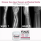 GFOUK™ Perfectx Joint And Bone Therapy Cream