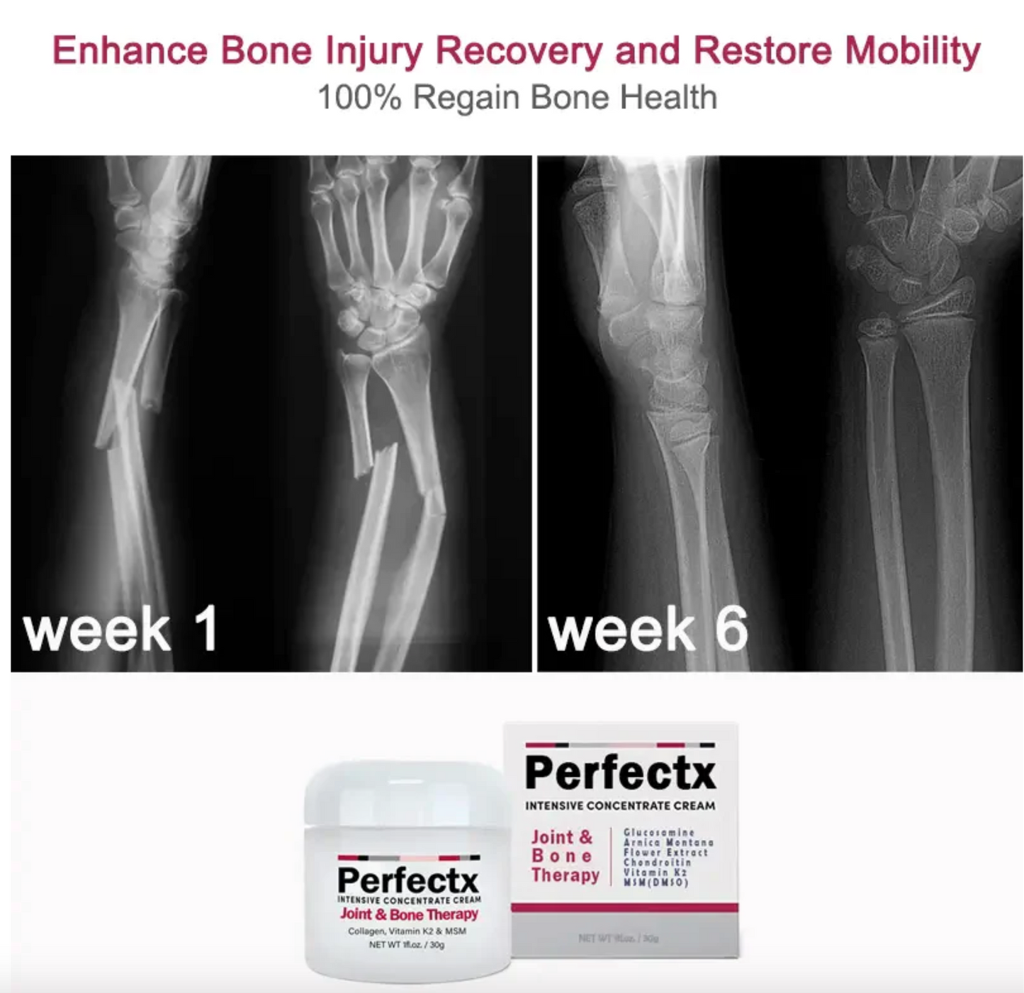 GFOUK™ Perfectx Joint And Bone Therapy Cream