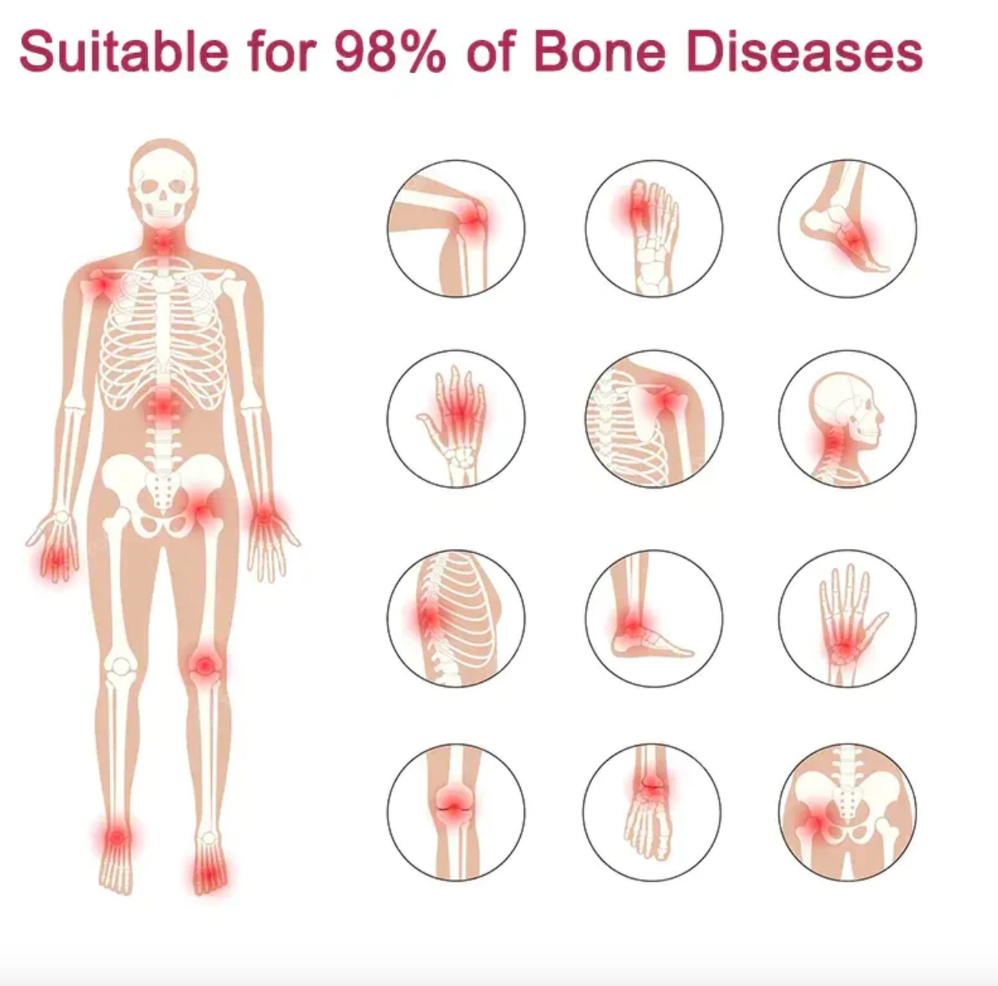 GFOUK™ Perfectx Joint And Bone Therapy Cream