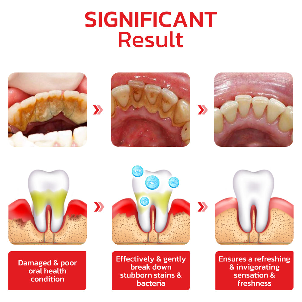 GFOUK™️ SP4 Probiotic Whitening Toothpaste