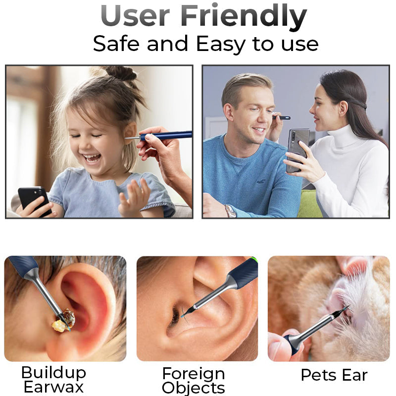 GFOUK™ WiFi 1080HD Visible Earwax Remover