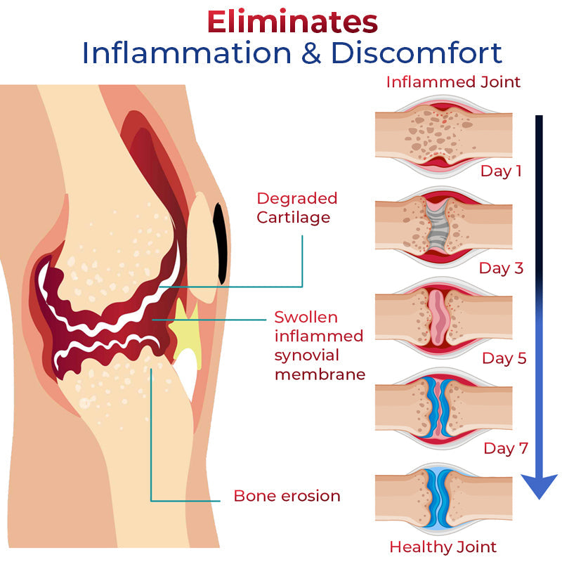 GFOUK™ JointMax Discomfort and Inflammation Relief Foam