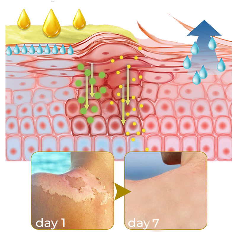 GFOUK™ Acanthosis Nigricans Peeling Oil