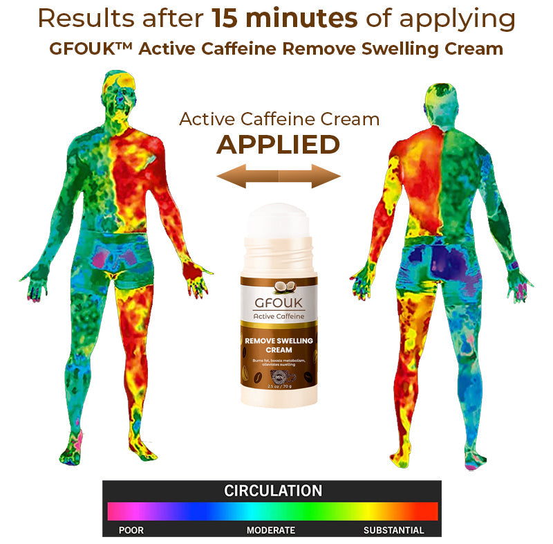 GFOUK™ Active Caffeine Remove Swelling Cream